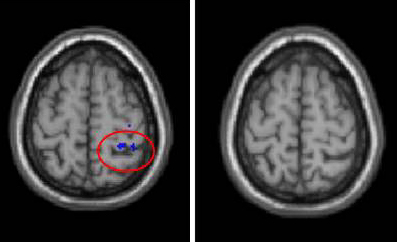 Old Brain vs. Young Brain