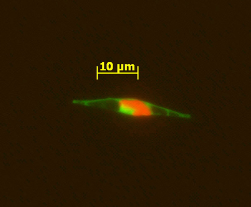 An epifluorescence micrograph of a marine alga indicates that the cobalamin acquisition protein 1 is associated with the outside of the cell wall, where it appears to facilitate bringing in vitamin B12 from the ocean into the cell.