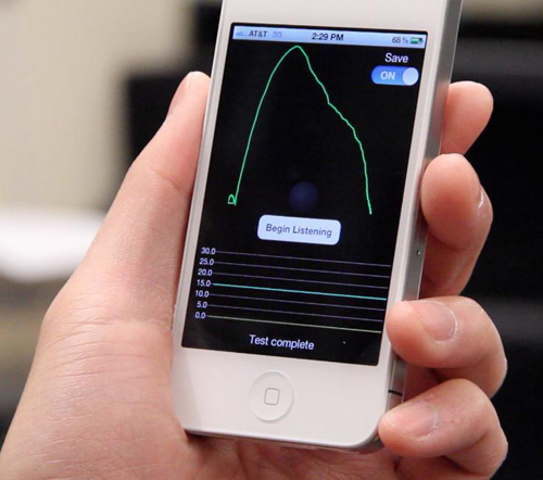 spirosSpiroSmart is a research app to let people test their lung function using only a smartphone.