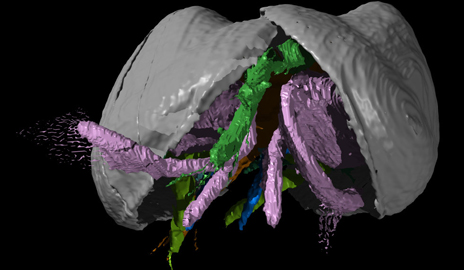 A frontal view of Pauline avibella, an unusual tiny fossil crustacean from 425 million years ago retaining soft body parts as well as its shell, including limbs, eyes, gills and alimentary system.