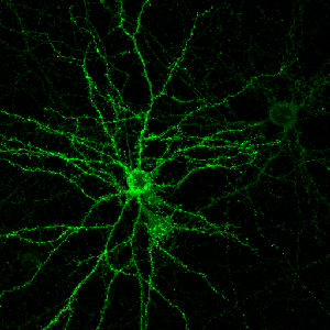 A cultured neuron with projecting dendrites studded with sites of communication between neurons, known as dendritic spines. Image credit: Yale University