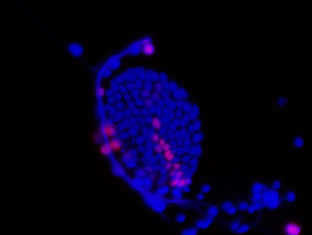 The red stripe of vn in the sac of blue cells is the first sign of a cascade of events that will produce a fly wing. Image credit: Ohio State University