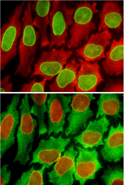 A cell specimen used for two rounds of testing. In the top panel, two biomarkers are stained green and red, and in the bottom, after the sample has been regenerated, the same biomarkers are stained red and green. This shows that the same tissue can be used for multiple rounds of testing without degrading the tissue sample. Image credit: Xiaohu Gao