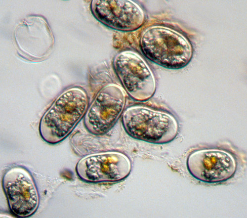 Scientists have known for many years that the phytoplankton Alexandrium fundyense is the cause of the harmful algae blooms that occur to varying severity each spring and summer along the coastal Gulf of Maine, sometimes extending as far south as Cape Cod and the adjacent islands, and in Georges Bank. In 1990, an Alexandrium bloom caused the closure of Georges Bank to harvest of surf clams and ocean quahogs, after fishermen were sickened from eating shellfish. (Photo courtesy Don Anderson, Woods Hole Oceanographic Institution)