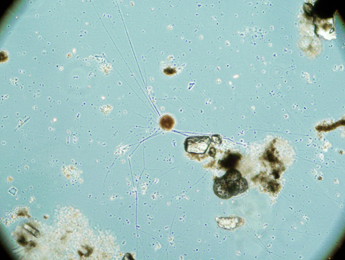A living thecate foraminiferan, with a plump cell body and numerous thread-like pseudopods (extensions) that it uses to capture prey and explore its surroundings. Thecate foraminifera produce a soft, organic sheath around themselves. (Photo by Joan Bernhard, Woods Hole Oceanographic Institution)