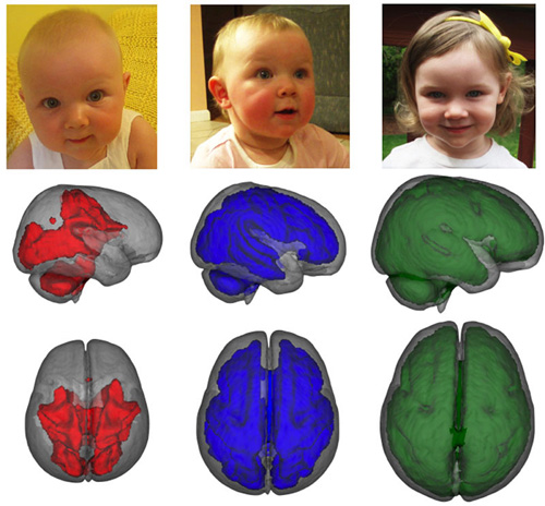 Support for the developing brain. MRI images, taken while children were asleep, showed that infants who were exclusively breastfed for at least three months had enhanced development in key parts of the brain compared to children who were fed formula or a combination of formula and breastmilk. Images show development of myelization by age, left to right. Image credit: Baby Imaging Lab/Brown University 