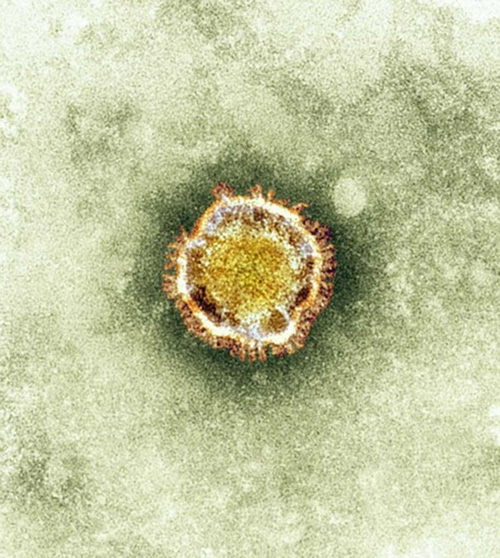 The new, deadly Human Coronavirus-Erasmus Medical Center was named for the Dutch hospital that identified the virus in a patient specimen. Image credit: University of Washington