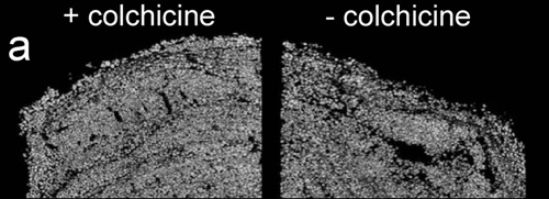 A pair of micro-CT scans of stromatolites that had been seeded with thecate foraminifera six months prior. The sample on the left had been treated with colchicine to prevent the foraminifera from developing pseudopods. The fine layers of sediment characteristic of stromatolites can be seen near the top of the sample. In the sample on the right, the foraminifera were allowed to make pseudopods. The fine structure of the sample has become clumpy and jumbled. (Photo courtesy of Leeann Louis, Beth Israel Deaconess)