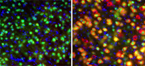 Brain disrupted. Neurons from the thalamus of control mice with healthy genes glow green (left), while those whose two Tsc1 alleles were deleted during embryonic development show a strong red glow (right), indicating disruption of the mTOR pathway that regulates growth. Image credit: Zervas Lab/Brown University 