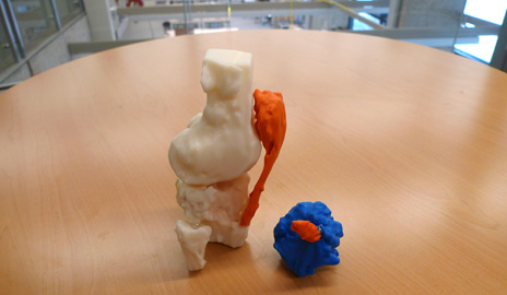 A Yale physician has begun using the 3D printers at Yale's Center for Engineering and Innovation Design to make 3D organs — precise replicas of actual patients' organs. Here, a knee with tumor. (Image by Yale CEID)