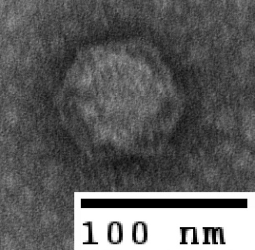 A tailless bacteriophage. Sullivan’s research group recently published a paper (see extra info) showing that about 80 percent of viruses found in the sea are non-tailed, while most research in this field has focused on tailed viruses. “It shows just how far we still have to go in understanding these systems,” Sullivan said. (Photo by: Natalie Solonenko)