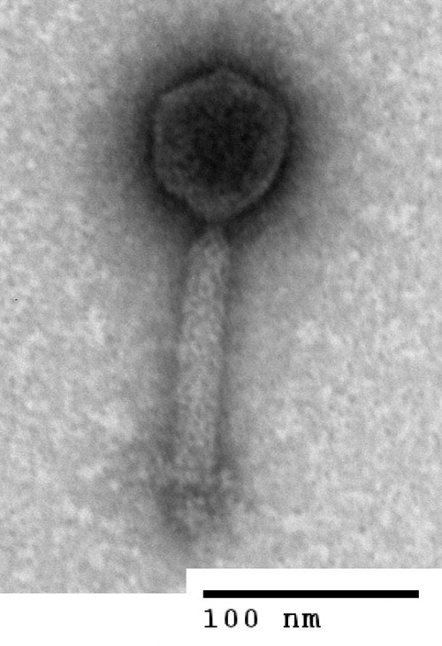 Bacteriophages come in different shapes and sizes. This one has a “head” containing the virus’ DNA and a “tail” with which it attaches to bacterial cells when it infects them. The scale bar in this electron microscope image is about one thousandth the diameter of a human hair. (Photo by: Natalie Solonenko)
