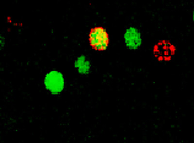 The researchers found that running prevents the activation of new neurons in response to stress. In sedentary mice, stress activated new neurons in the hippocampus (red and green cell above), but after 6 weeks of running, the stress-induced activation of both new and mature neurons disappeared. The red cells are new neurons and the green cells are activated mature neurons. (Photo courtesy of the Gould laboratory)