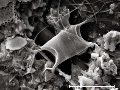 A scanning electron microscope image reveals a resting spore of the Chaetoceros diatom, a kind of phytoplankton that may have grown abundant during the burst of biological activity that followed the end of the last Ice Age in the North Pacific Ocean. (Photo by Beth Caissie)