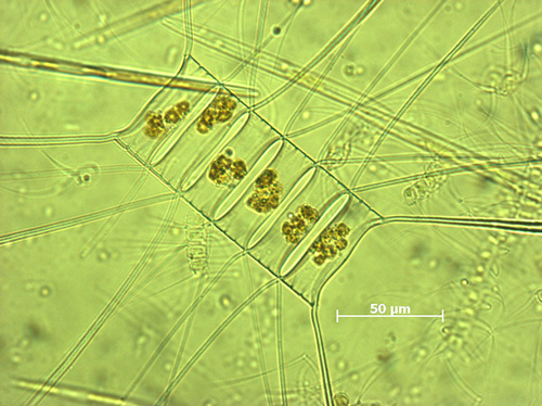 Marine plankton diatom, Chaetoceros decipiens, is catalogued in the MAREDAT atlas. (Photo courtesy of Karine Leblanc, Mediterranean Institute of Oceanography.)