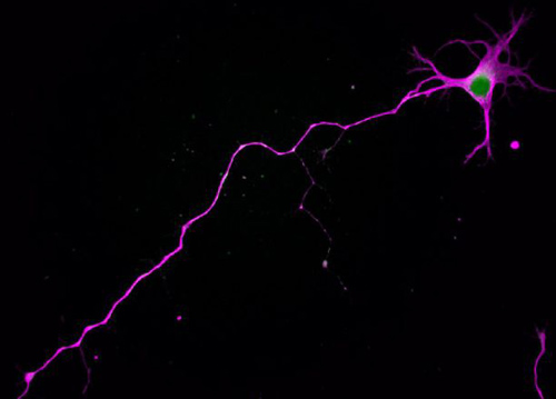 A nerve cell showing its characteristic polarity: The cell body sends one long axon in one direction, while branch-like dendrites sprout in others. (Photo by: Sara Parker)