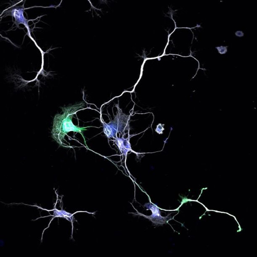 Nerve cells use their dendrites and axons to connect with each other and form neural networks. (Photo by: Sara Parker)
