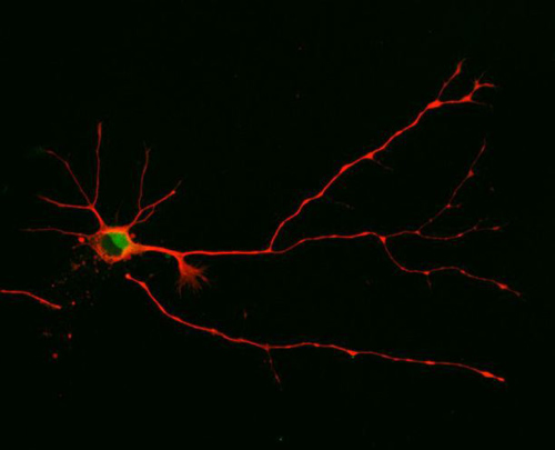 In this study, UA researchers discovered that a neuron will form multiple axons as seen here when they blocked the short version of a signaling molecule from functioning. (Photo by: Sara Parker)