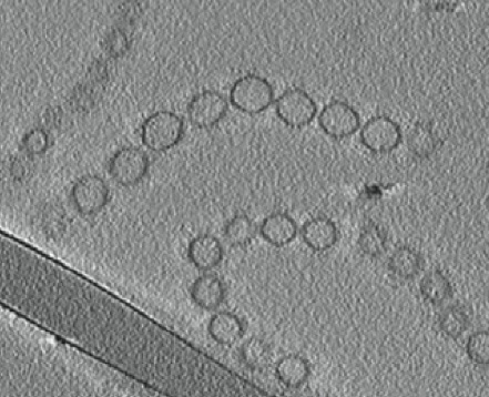 Slice-through cryo-electron tomographic reconstruction of isolated vesicle chains reveals that each vesicle chain is made up of vesicles of a similar size. The scientists found that vesicle size can vary between different vesicle chains, suggesting a tight control of vesicle chain formation. (Image credit: Auer lab)