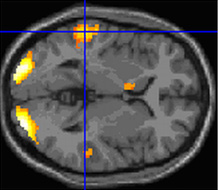 Scientists mapped brain activity when subjects read poetry and prose. Image credit: University of Exeter 