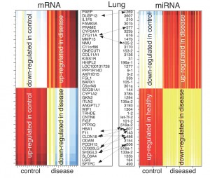 'Surprisal analysis' provides a method to characterize how cellular energy is distributed in cancer cells to express critical genes. Image: The thermodynamic lung cancer-specific gene (mRNA and miRNA) signature.  This figure illustrates that genes that up-regulated in the lung cancer state are down regulated in normal controls, and genes that are highly up-regulated in the normal controls are down-regulated in the lung cancer state. There is a clear, correlated gene-expression behavior present that not only characterizes the lung cancer state but can also be used to distinguish cancer patients from non-cancer patients.  Image credit: PNAS/Sohila Zadran, Raphael Levine, Francoise Remacle (Click image to enlarge)