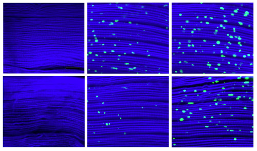 Messy muscle. More protein aggregates, shown as green specks, built up over 1, 3, and 5 weeks (left to right) in the muscle fibers of control flies (top row) compared to those in which dawdle, which hinders their cleanup, was suppressed (bottom row). Image credit: Tatar lab/Brown University 