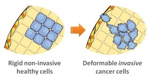 A transition to invasive malignant cells in a tumor is associated with the cell's increased ability to stretch, which may allow for invasion through tight tissue junctions. Image credit: University of California (Click image to enlarge)