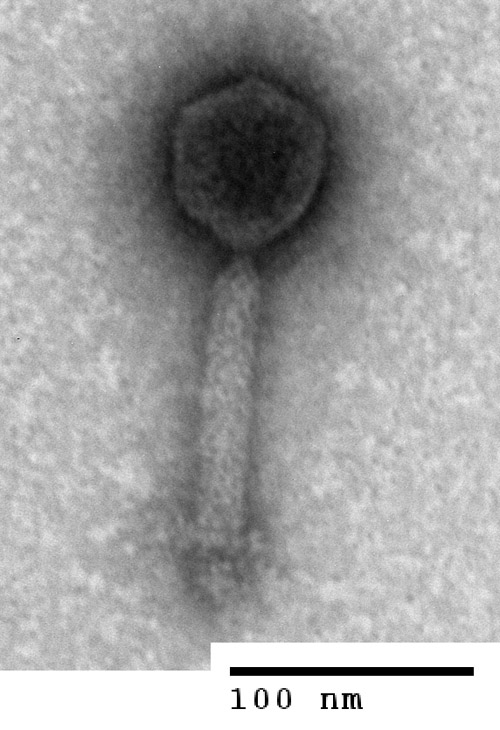 Bacteriophages come in different shapes and sizes. This one has a "head" containing the virus' DNA and a "tail" with which it attaches to bacterial cells when it infects them. The scale bar in this electron microscope image is about one-thousandth the diameter of a human hair. (Photo by: Natalie Solonenko)