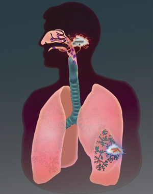 Flying under the radar: tuberculosis-causing mycobacteria initiate infection in the lower lung to evade pathogen-killing cells. Image credit: Ramakrishnan lab