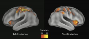 When these brain regions (mostly associated with control) aren't active enough, we make risky choices. Z-statistic corresponds to predictive ability, yellow being the most predictive regions. Image: Sarah Helfinstein/U. of Texas at Austin (Click image to enlarge)