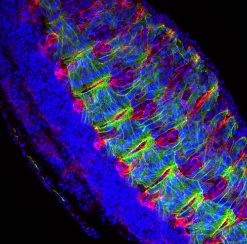 Mikroskopische Aufnahme eines Taufliegenembryos, in dem der molekulare „Schutzengel“ namens mikroRNA-9a  „abgeschaltet“ wurde. Die Muskeln der Fliege (grün), das Muskelprotein Dystroglykan (rot) und die Zellkerne (blau) sind deutlich erkennbar. Image credit: © Shcherbata / Max-Planck-Institut für biophysikalische Chemie 
