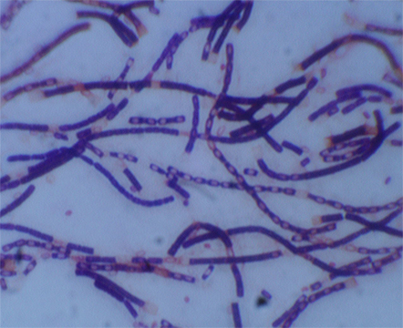 Anthrax bacteria are rod-shaped and transmitted through abrasions in the skin or through inhalation. Image credit: University of Missouri