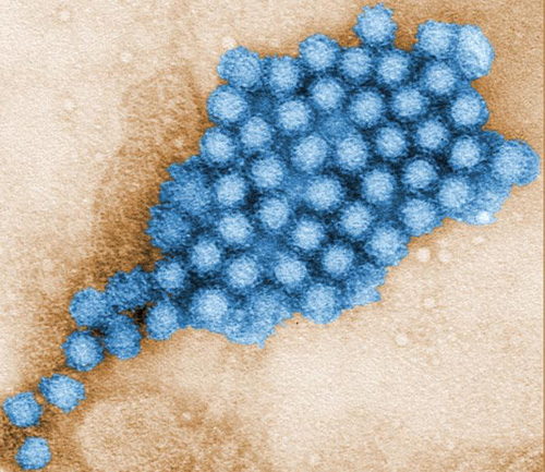 Norovirus particles have a tough outer shell that makes them persistent in the environment and difficult to eliminate. (Photo credit: U.S. Centers for Disease Control and Prevention)