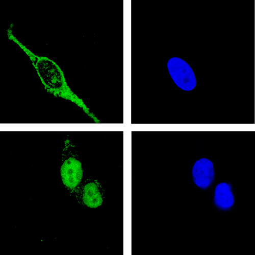 Die Bindung von RNA behindert den Import von ADAR1 in den Zellkern: Hat ADAR1 RNA gebunden, findet man das Protein im Zytoplasma der Zelle (oben). Ist keine RNA vorhanden, kann ADAR1 zurück in den Zellkern wandern (unten). Der Zellkern ist blau markiert. (Image copyright: Michael Jantsch)