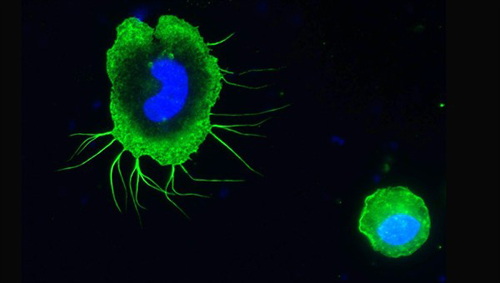 Makrophagen in Schwerelosigkeit. Image credit: DLR