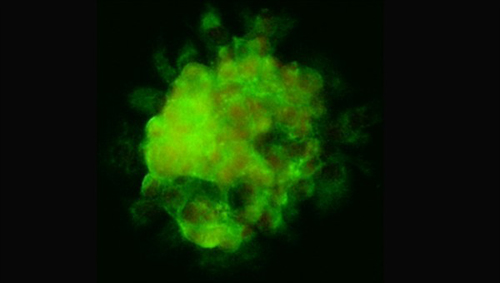 Multizelluläres Sphäroid aus menschlichen Schilddrüsenkrebszellen. Image credit: DLR