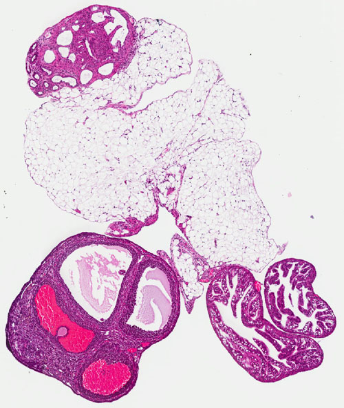 Possible culprits hiding in plain sight. A mouse ovary showing potentially precancerous changes. The over- or under-representation of proteins called TAFs, once thought benign parts of the genetic machinery, may be implicated in ovarian cancers. Image credit: Caitlin Brown/Freiman lab/Brown University 