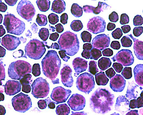 A microscopic image of erythroblasts, the bone marrow cells that secrete erythroferrone. Image credit: Leon Kautz