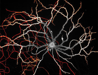 Die Wissenschaftler endeckten einen Mechanismus der die Dopamin-ausschüttenden Nervenzellen - im Bild - bei Morbus Parkinson schützen kann. Foto credit: Gerald Obermair