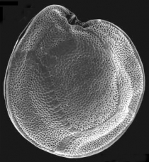 Der marine Dinoflagellat Gambierdiscus toxicus produziert Gifte, die für den Menschen gefährlich werden können. Image credit: © Senckenberg