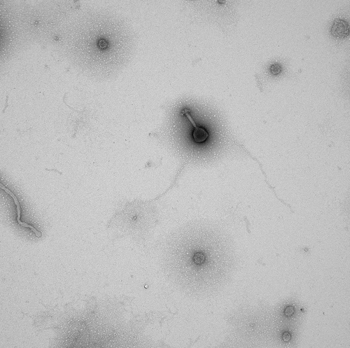 Electron microscopy image of a virus sample collected during a research cruise with the "Western Flyer" off the coast of Monterey Bay, California. (Photo credit: Sullivan lab)