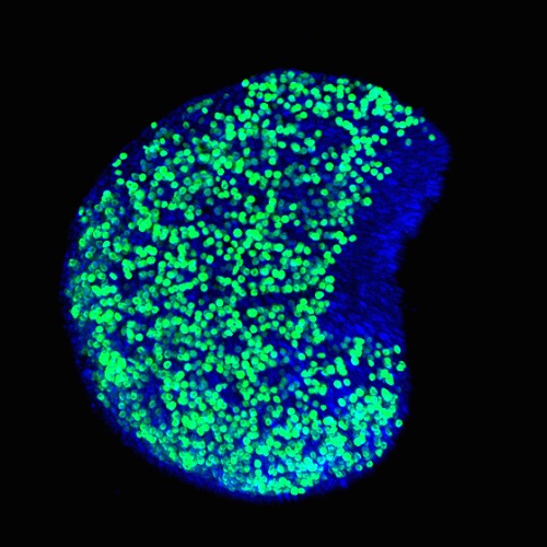 This image shows mouse fetal ovary whose eggs (colored green) were protected from dying by AZT. Blue color identifies genomic DNA in all cells of the ovary. Image is courtesy of Safia Malki.