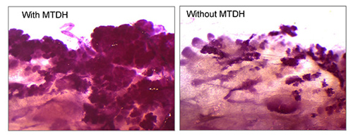 A team led by researchers at Princeton University has found that a gene known as Metadherin, or MTDH, promotes the survival of tumor-initiating cells via the interaction with a second molecule called SND1. Mammary tissue was taken from mice (stained red for visualization) that were genetically engineered to develop breast cancer in the presence (left) or absence (right) of MTDH. The dark-pink, cloud-like structures indicate the initiation of mammary tumors, which were largely suppressed by loss of the MTDH gene. (Image courtesy of Yibin Kang, Department of Molecular Biology)