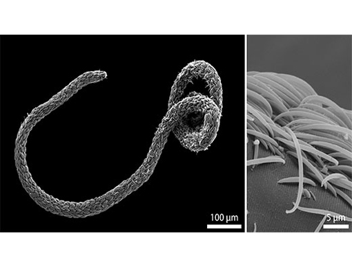 Rasterelektronenmikroskopische Aufnahme eines Eubostrichus fertilis Wurms (links). Die sichelförmigen bakteriellen Zellen sind auf seiner Oberfläche wie Schichten einer Zwiebel angeordnet (rechts). Image credit: Universität Wien