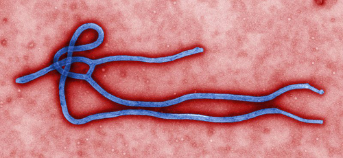 Ebola virus virion. Created by CDC microbiologist Cynthia Goldsmith, this colorized transmission electron micrograph (TEM) revealed some of the ultrastructural morphology displayed by an Ebola virus virion. Image credit: CDC/Cynthia Goldsmith (Source: Wikipedia)