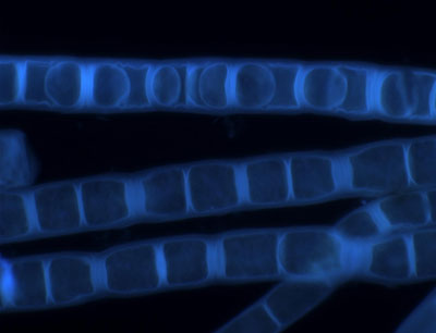 Fluoreszenzmikroskopische Aufnahme der Zygogonium ericetorum, zur Darstellung der Zellwand (im obersten Algenfaden sind Aplanosporen zu sehen) (Bild credit:  R. Stancheva)