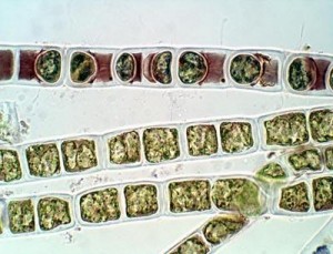 Lichtmikroskopisches Bild von Zellfäden der Zygogonium ericetorum. Im obersten Algenfaden sind die ausgebildeten Aplanosporen zu sehen. (Bildcredit:  R. Stancheva)