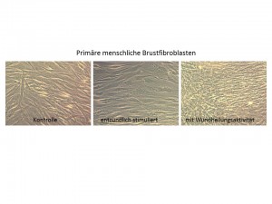 Links: unbehandelte Fibroblasten. Bildmitte: Nach einer entzündlichen Aktivierung sieht man kaum Unterschiede. Rechts: Die Aktivierung der Wundheilungsaktivität führt zu einer erhöhten Zelldichte. Image copyright: Universität Wien (Click image to enlarge)