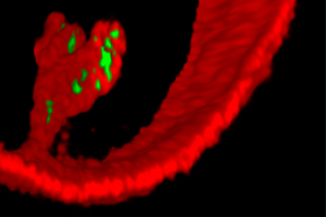 Pseudomonas aeruginosa (grün) dringt mithilfe des Lipid-Reißverschlusses in ein synthetisches Vesikel ein (rot).(Bild Quelle: Thorsten Eierhoff)
