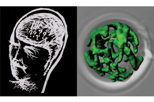 Bei der Demenzerkrankung Alzheimer werden die Mitochondrien (grün) in Zellen blockiert. (Bild Quelle: Chris Meisinger/BIOSS)
